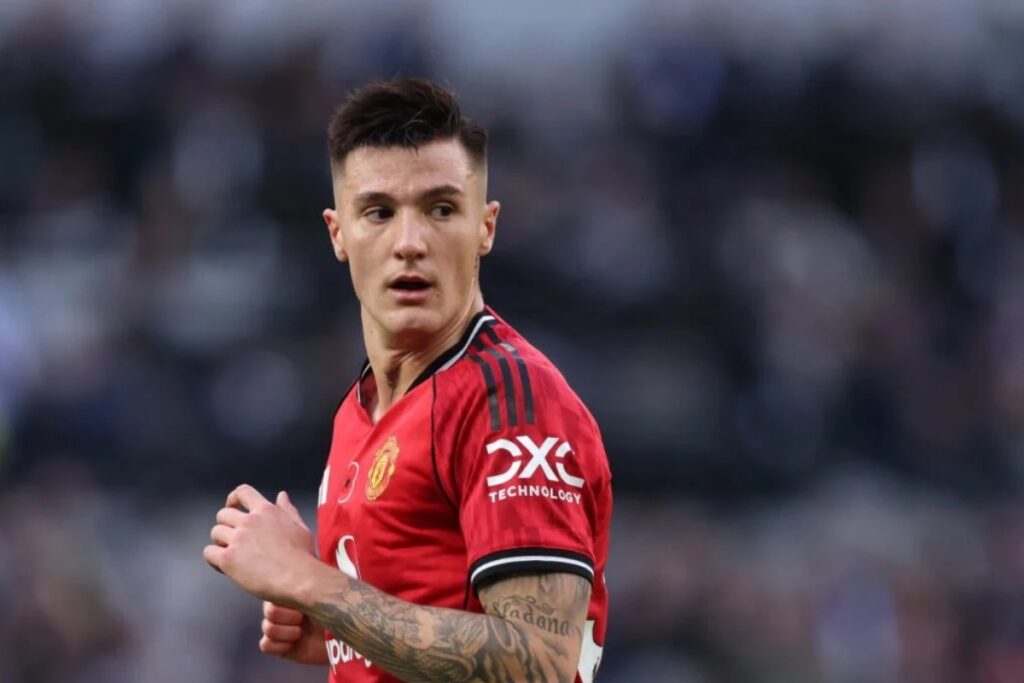 Shesko Set to Return from Injury; Relief for Manchester United Shesko Set to Return from Injury; Relief for Manchester United